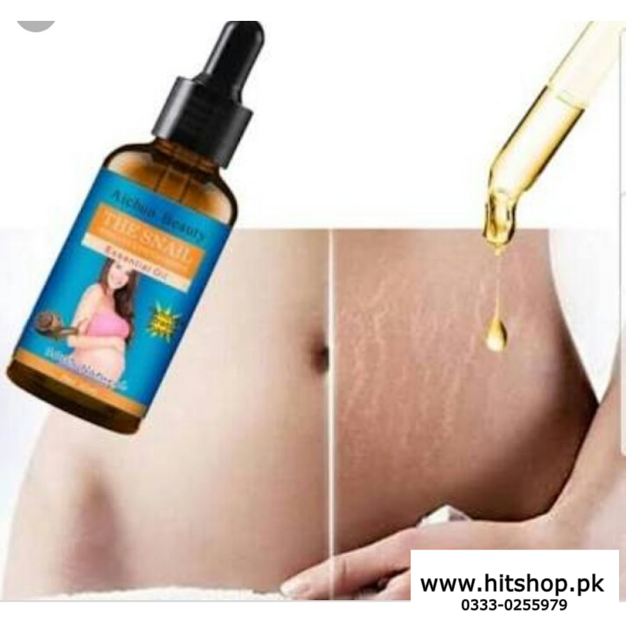 Stretch Marks Remover 